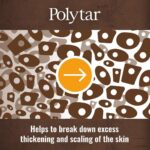 Polytar Scalp Shampoo, For Scalp Conditions, Reduces Itching, Inflammation and Scales, Shampoo Treats Psoriasis, Seborrhoeic Dermatitis, Eczema and Dandruff, Contains Coal Tar Solution, 1 x 150ml - Image 4