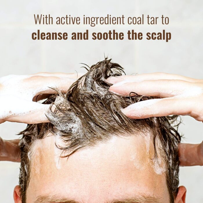 Polytar Scalp Shampoo, For Scalp Conditions, Reduces Itching, Inflammation and Scales, Shampoo Treats Psoriasis, Seborrhoeic Dermatitis, Eczema and Dandruff, Contains Coal Tar Solution, 1 x 150ml - Image 6
