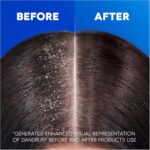 Head & Shoulders Classic Clean 2in1 Anti Dandruff Shampoo, 1000ml. Up to 100% Flake Free, Clinically Proven. For Any Hair and Scalp Type. For Daily use. Clean Feeling - Image 7